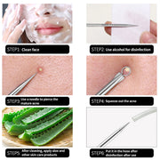 4PCS Acne Blackhead Remover Set